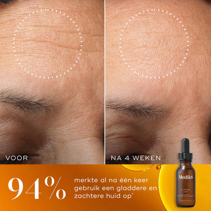 C-Tetra Luxe (14% vitamine C)